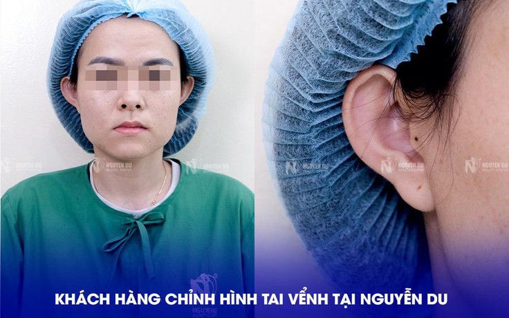 Bác sĩ Lý Tấn Việt - bác sĩ chỉnh hình tai vểnh tại TP.HCM