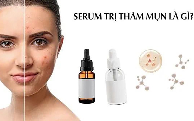 Top 10 serum trị thâm mụn cho làn da tươi sáng rạng ngời được tìm mua nhiều