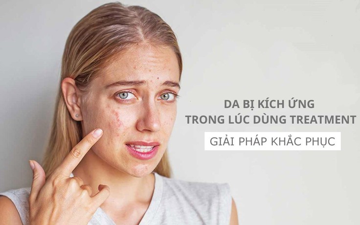 Làm gì khi da bị kích ứng trong lúc sử dụng treatment?