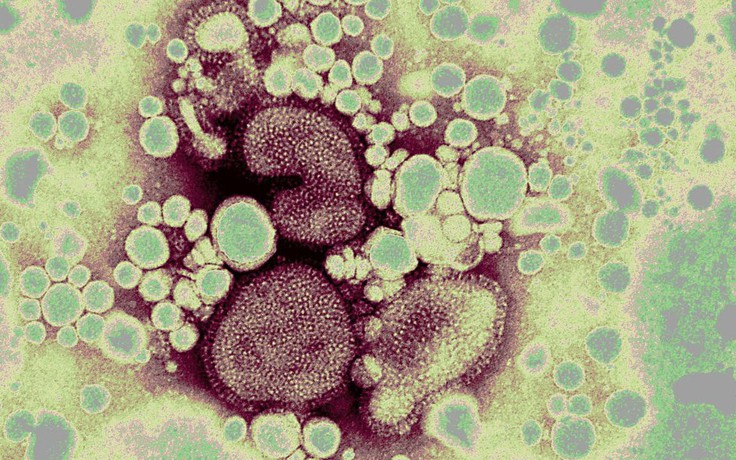 WHO cảnh báo nguy cơ cúm gia cầm lan ra bò ở nhiều nước