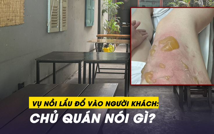 Toàn cảnh vụ nồi lẩu bò đổ vào người: Khách tố nhân viên không hỗ trợ, chủ quán 'phản pháo'