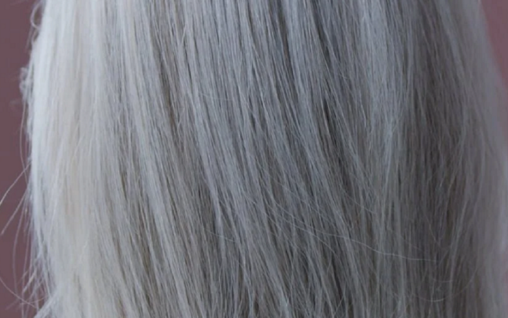 4 dấu hiệu kỳ lạ ở da, tóc cảnh báo cơ thể thiếu vitamin