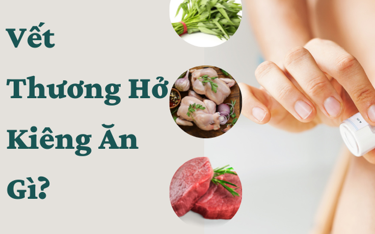 Vết thương hở kiêng ăn gì để mau lành và ngừa sẹo hiệu quả?