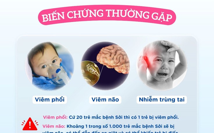 Cần biết những biến chứng nguy hiểm của bệnh sởi