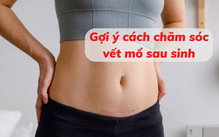 Mách mẹ cách chăm sóc vết mổ sau sinh nhanh lành và không để lại sẹo