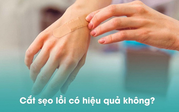 Phẫu thuật sẹo lồi có hiệu quả không? Làm thế nào để ngăn sẹo lồi tái phát?