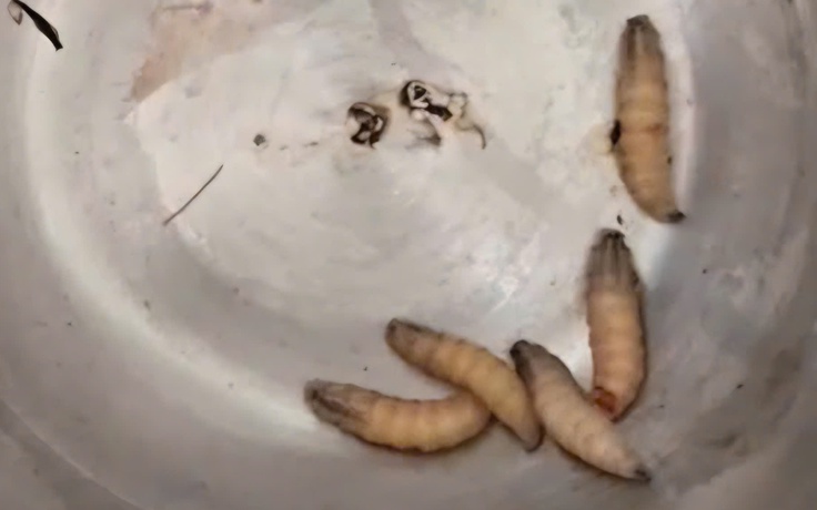 Gắp 5 con giòi sống trong tai bệnh nhân