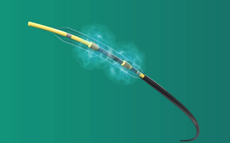 Ứng dụng công nghệ phá vôi lòng mạch mới điều trị hẹp mạch vành phức tạp