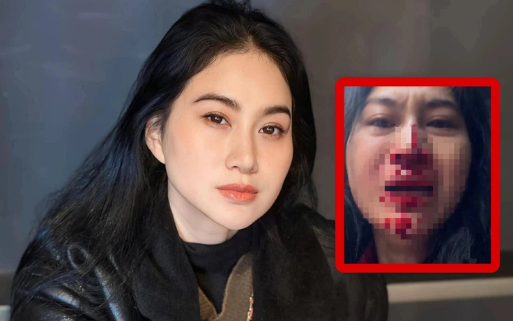 Diễn viên Phi Ngọc Ánh mặt đầy máu, cầu cứu trên livestream