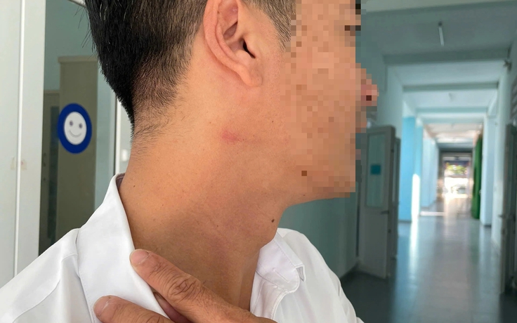 Vụ thầy giáo hành hung đồng nghiệp: Nhà trường đề nghị công an vào cuộc