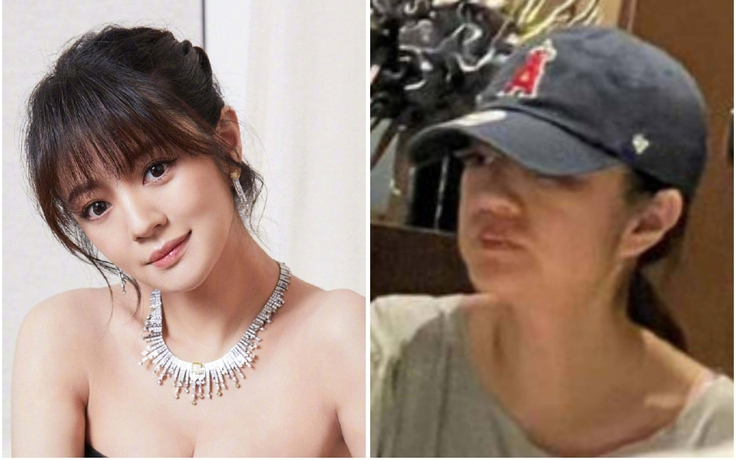 Hình ảnh 'sốc' của An Dĩ Hiên sau biến cố chồng đại gia ngồi tù