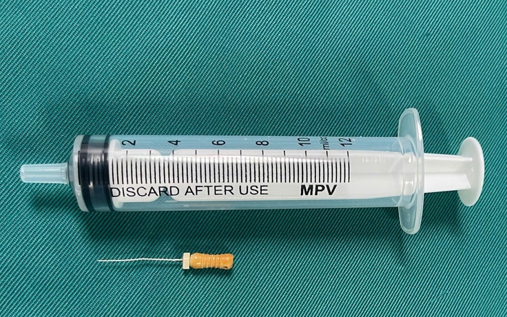 Đi làm răng, kim chọc tủy dài 22 mm 'cắm' vào đường thở bé trai 3 tuổi