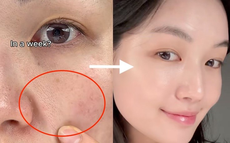 Retinol nào ‘vừa mạnh vừa lành tính’? Top 3 giúp cải thiện nếp nhăn, không bong tróc!
