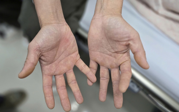 Đứng dậy là ngã, sau thời gian dài hít bóng cười