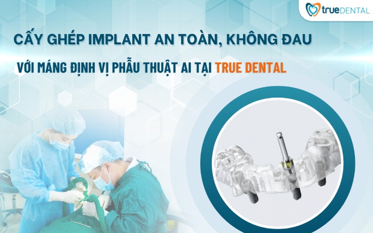 Cấy ghép Implant an toàn, không đau với máng định vị phẫu thuật AI tại True Dental