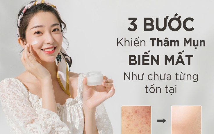 3 bước biến hình làn da, thâm mụn ‘biến mất' như chưa từng tồn tại