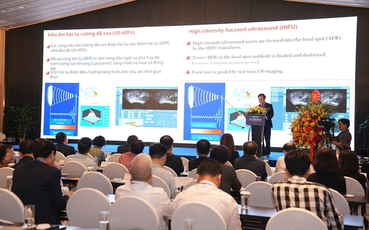 Điều trị khối u bằng sóng siêu âm, không phẫu thuật