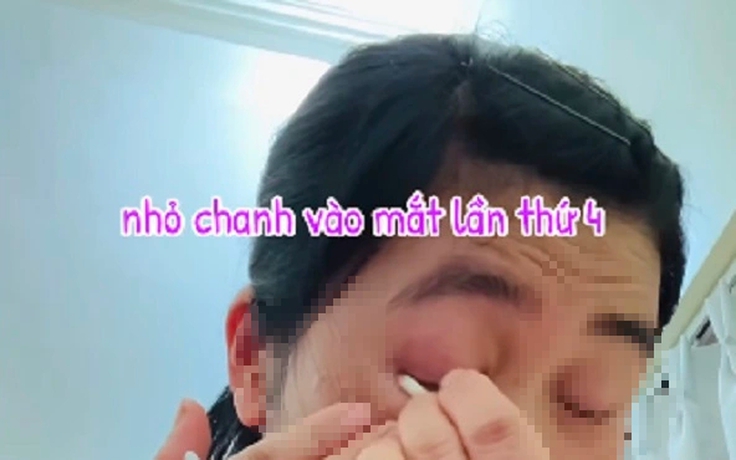 Nhỏ nước chanh vào mắt gây nguy hiểm cho thị lực như thế nào?