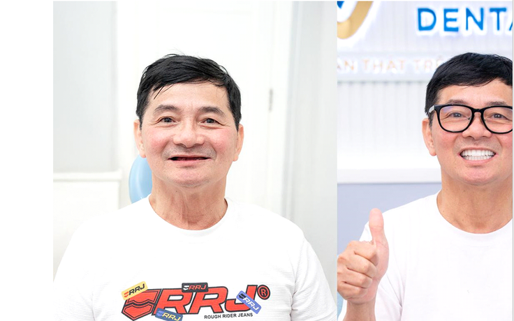 Nha khoa SGC Dental Center: Nơi Việt kiều an tâm gửi trọn nụ cười Nha khoa SGC Dental Center: Nơi Việt kiều an tâm gửi trọn nụ cười