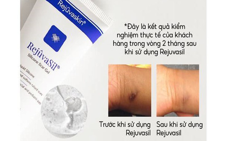 Cách ngừa sẹo và trị sẹo chuẩn y khoa hiệu quả tại nhà không cần xâm lấn