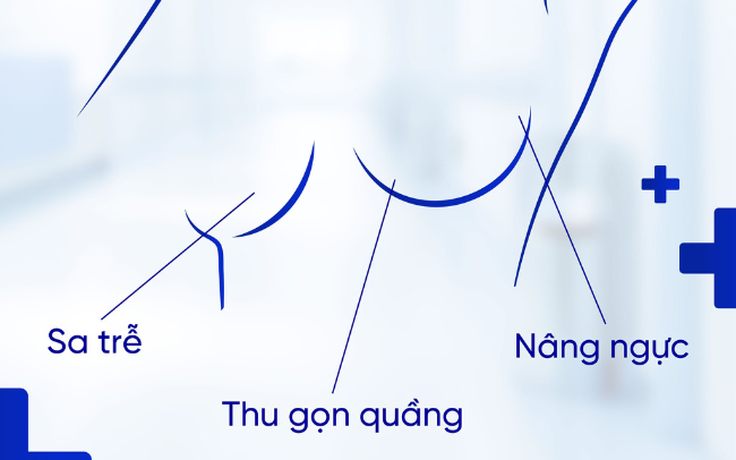 Những sai lầm cần tránh để có vết sẹo đẹp sau nâng ngực
