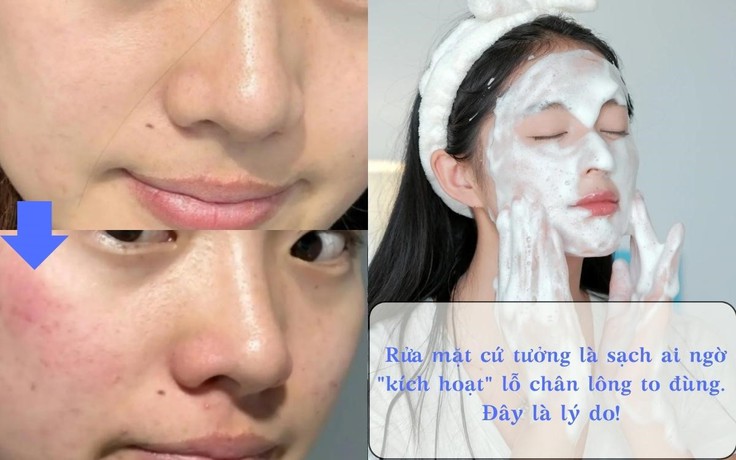Rửa mặt cứ tưởng là sạch ai ngờ ‘kích hoạt’ lỗ chân lông to đùng!