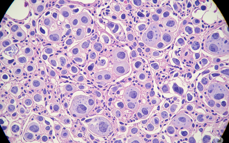 Vắc xin mới chống 2 loại ung thư nguy hiểm: Hiệu quả đầy hứa hẹn