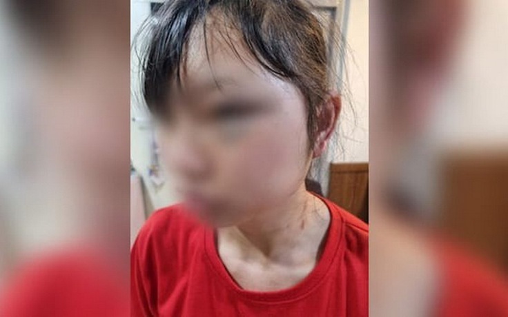 Hàn Quốc tuyên án vụ đánh đập thô bạo một nữ lao động người Việt