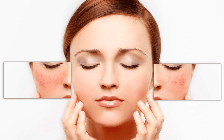 Vì sao làn da dễ mất cân bằng khi thời tiết thay đổi liên tục?