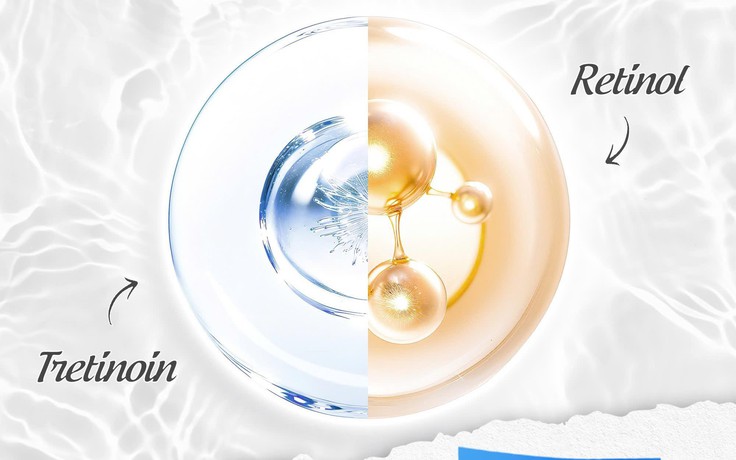 Tretinoin hay Retinol: Ai là ‘trùm cuối’ cho da, đừng nhầm lẫn mà ‘tiền mất tật mang’
