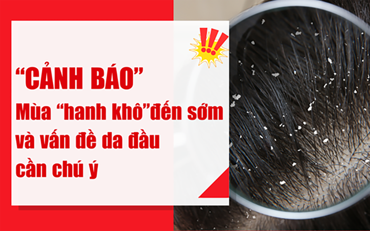 Mùa hanh khô 2025 sớm và khắc nghiệt, gàu ngứa dễ ‘tấn công’ da đầu nhạy cảm