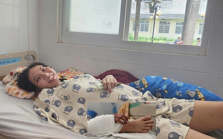 TP.HCM: Phẫu thuật thành công ca ghép bàn tay vào chân cho bệnh nhân mang song thai