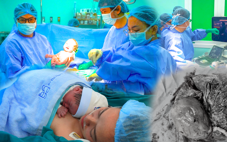 Ca can thiệp bào thai cực hiếm, cứu thai nhi mắc khối u nhau thai khổng lồ