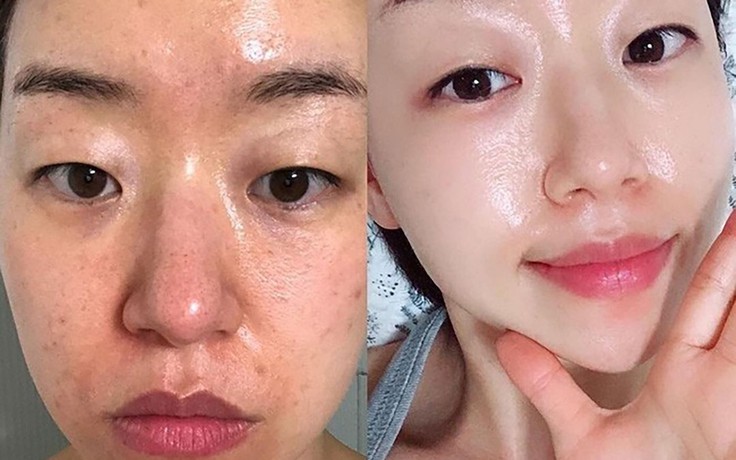 Top 8 kem trắng da chống lão hóa đang được chị em 'săn lùng' trước Tết