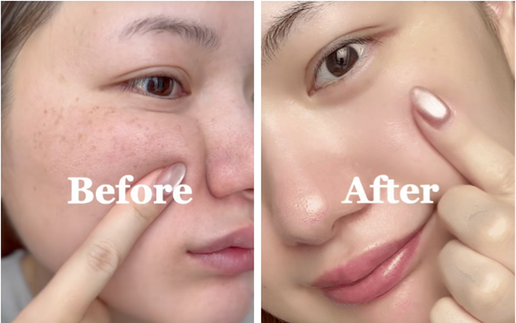 Top 7 serum làm mờ nám đậm, nám sâu tới đâu cũng hiệu quả