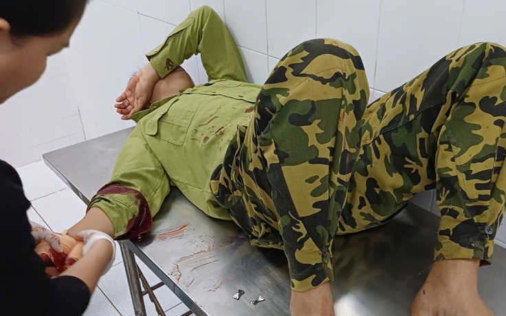 Đi kiểm tra rừng, một bảo vệ bị người đàn ông lạ mặt chém bị thương 
