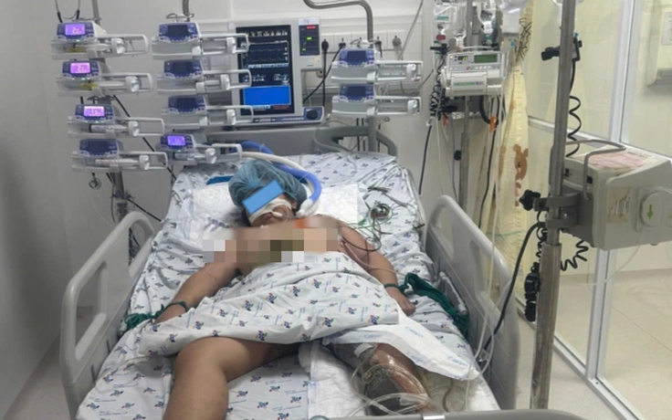 Bệnh viện Nhi đồng thành phố cứu bé gái 9 tuổi bị lóc da nghiêm trọng vì tai nạn