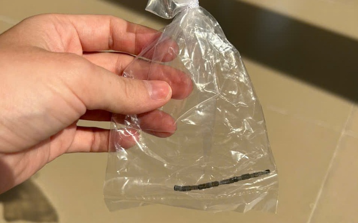 Nuốt thanh nam châm, bé trai 32 tháng tuổi bị thủng ruột