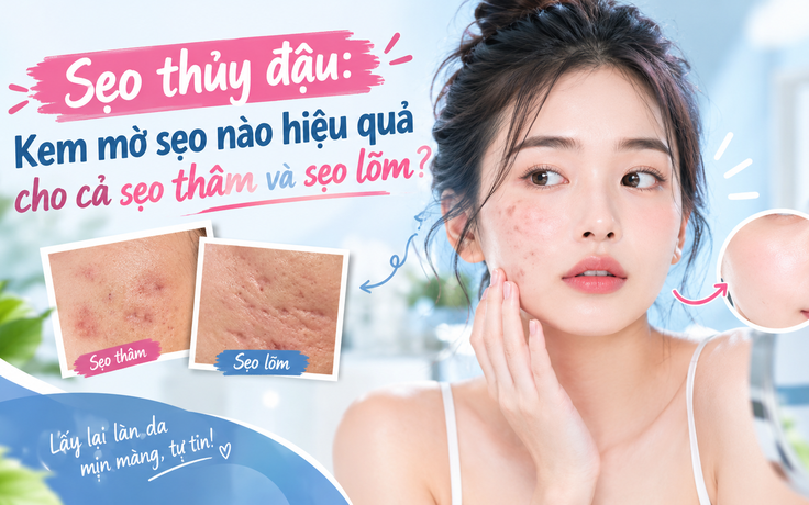 Sẹo thủy đậu: Kem mờ sẹo nào hiệu quả cho cả sẹo thâm và sẹo lõm?