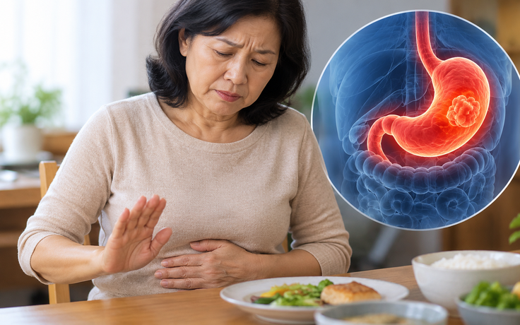 4 dấu hiệu ung thư dạ dày dễ bị nhầm với rối loạn tiêu hóa