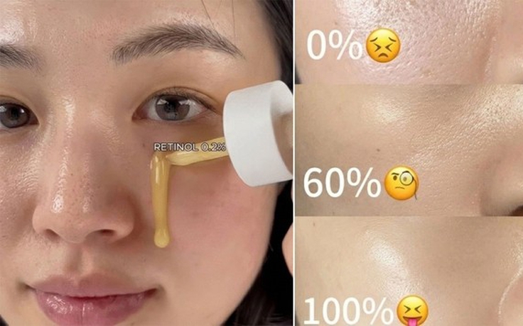 Retinol cho người mới bắt đầu: Đừng để nỗi sợ kích ứng mà quên ‘hoạt chất vàng’