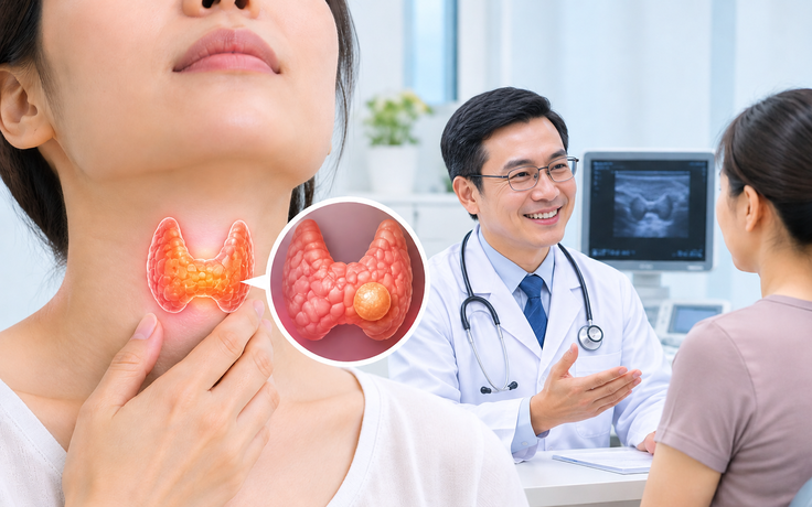 Bác sĩ 24/7: Nhân giáp lành tính có cần phẫu thuật không?