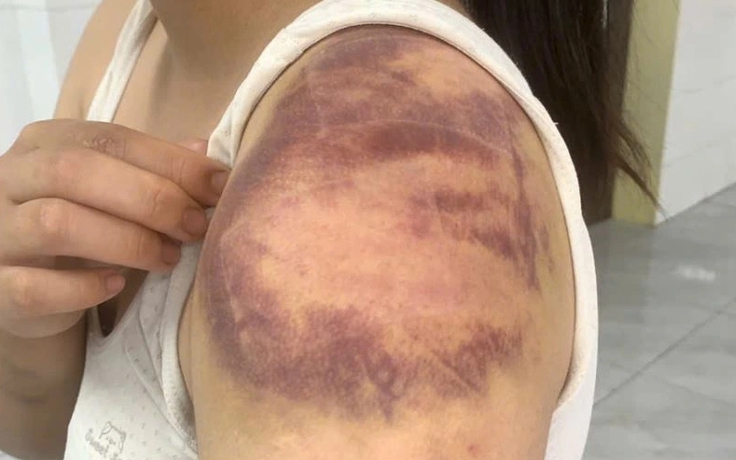 Tạm giữ hình sự đối tượng trói, đánh con ruột, hành hạ vợ mang thai