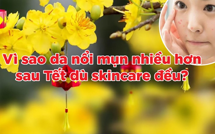 Vì sao da dễ nổi mụn sau Tết dù skincare rất kỹ?