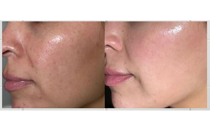 7 kem trắng da chống lão hóa giúp làn da tuổi 40 căng trẻ, mịn màng