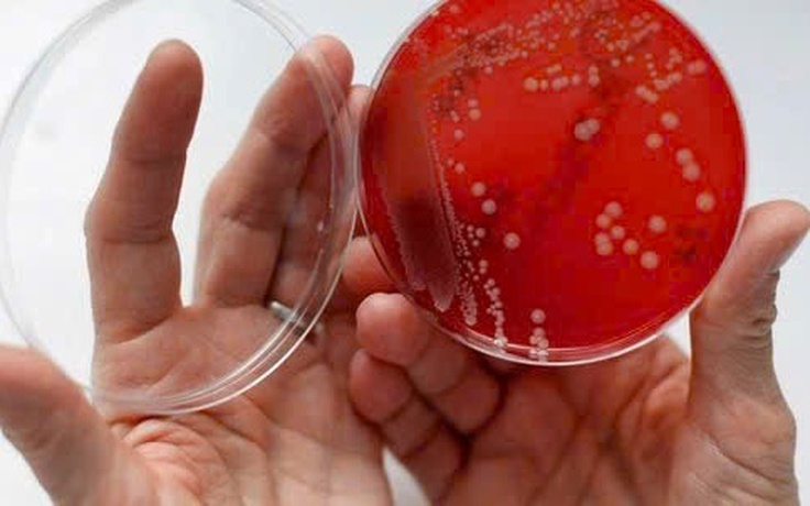 'Siêu vi khuẩn' tấn công não, tim khiến thiếu nữ 16 tuổi nguy kịch