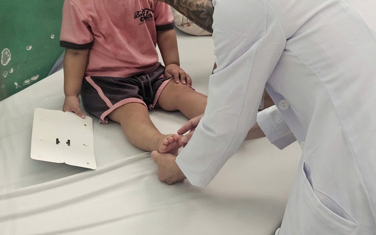 Bác sĩ cảnh báo dấu hiệu tay chân miệng nguy hiểm hơn nổi ban và loét miệng