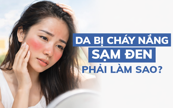 Nắng nóng gần 40 độ: Da bỏng rát, sạm màu? Cách phục hồi sau 1 đêm