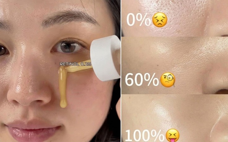 Top 5 retinol đa nhiệm từ mờ nám sạm tới chống lão hóa giúp da căng bóng