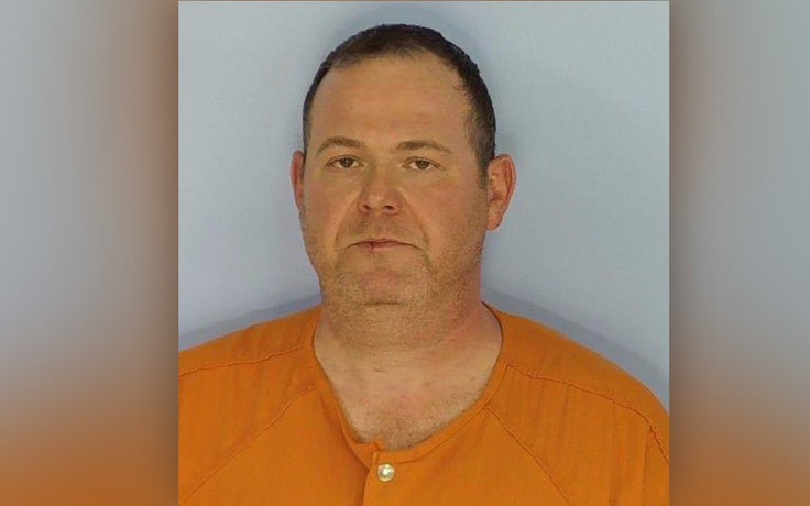 Mỹ truy tố bác sĩ cắt nhầm gan của bệnh nhân thay vì lá lách